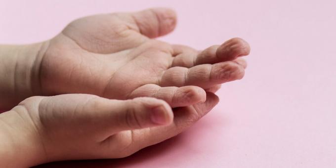 Reacții ale corpului: îndoirea pielii pe degete