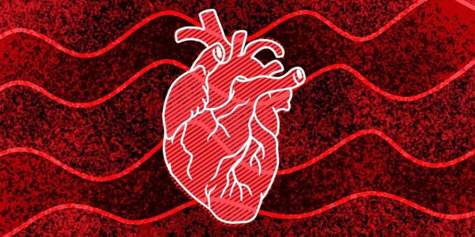 11 semne că s-ar putea întâmpla stop cardiac