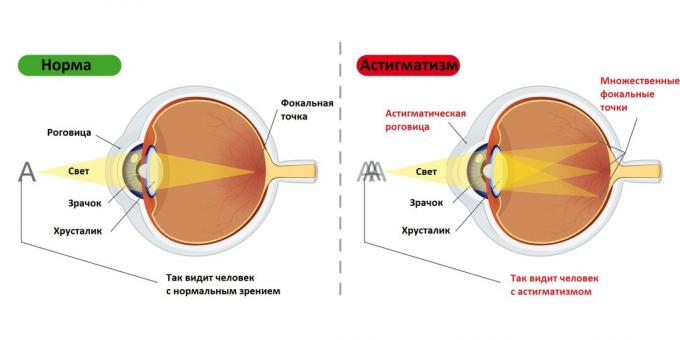 Viziunea unei persoane cu și fără astigmatis