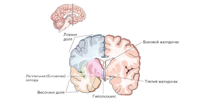 Ventriculii cerebrali. Acumularea de lichid în ele duce la hidrocefalie.