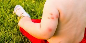 Ce trebuie să faceți dacă sunteți alergic la mușcăturile de țânțari și musc
