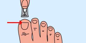 Care sunt cauzele greșit unghiile tunsoare și cum pentru a evita problemele de sănătate