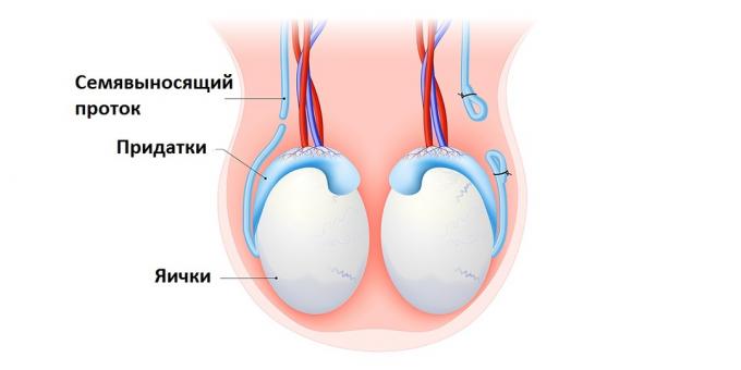 Vasectomie