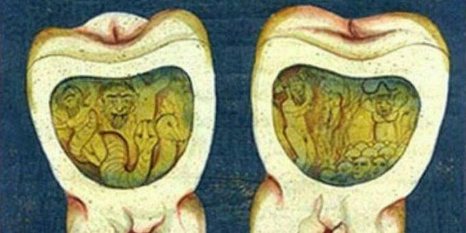 Medieval Medicine: A Page From Ottoman Dental Treatise, Century XVII.