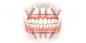 Cum de a restaura dintii și zâmbet înapoi
